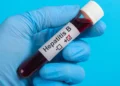 Un medicamento para la hepatitis B podría ofrecer una ‘cura funcional’