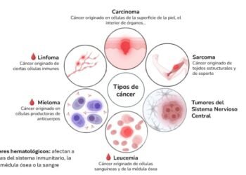 Cáncer de tiroides: síntomas, factores de riesgo y chequeos médicos necesarios